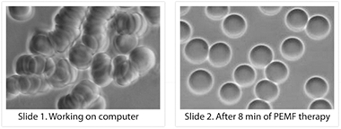 圖22：PEMF 增加細胞電壓並逆轉緡錢狀紅細胞堆疊效應