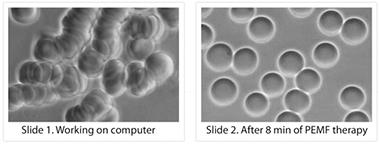 圖27：使用源於地球自然的PEMF 設備猶如給自己進行一次「電磁浴」